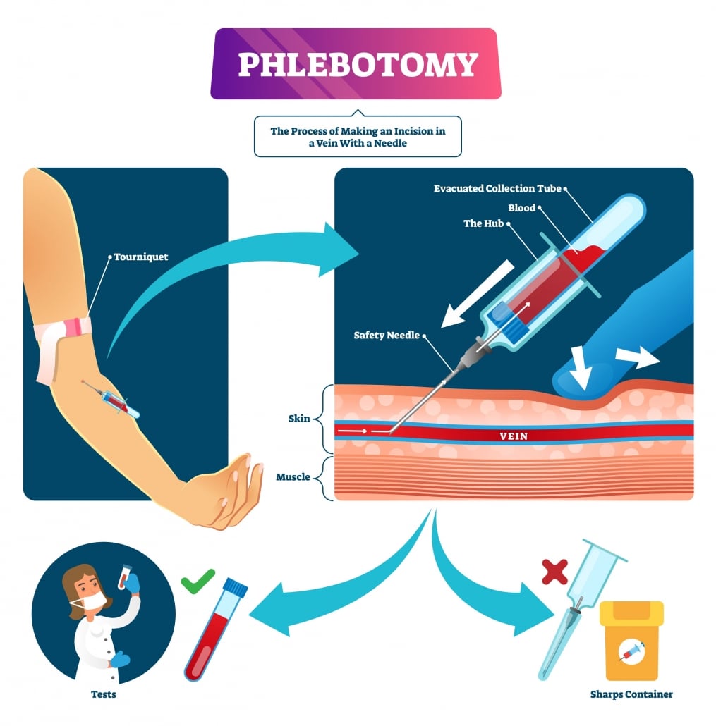 Phlebotomy Guide